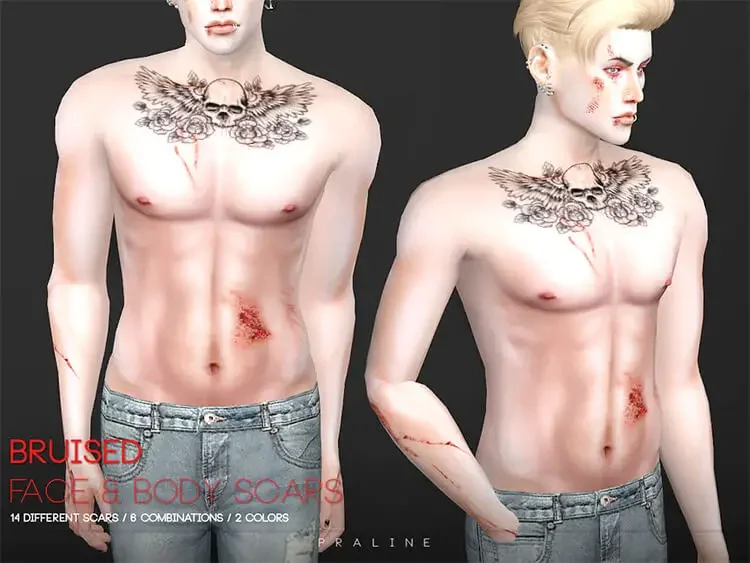19 bruised face body scars sims 4 cc 1 21 Sims 4 Injury CC: Scars, Bruises & Bandages