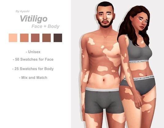80179d6165a12597b20cbd110d19425a 15 Best Sims 4 Viltiligo CC & Mods