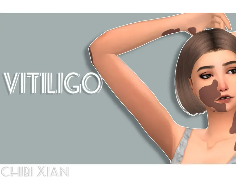 w 920h 690 2729638 15 Best Sims 4 Viltiligo CC & Mods
