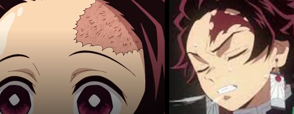 Tanjiro 1 Why does Tanjiro’s scar change? Why does he have a Scar?